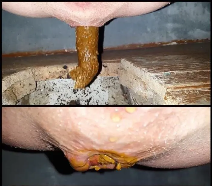 Outdoor Village Toilet 5 Shit Compilation FullHD 1080p (Anna Coprofield /  2018) 1.07 GB ScatVip.com