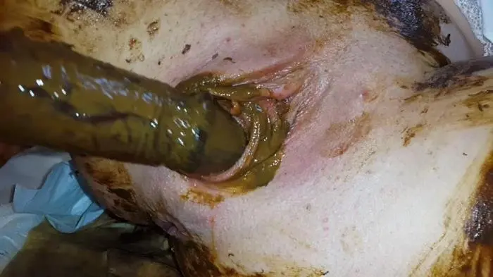 Gynecological Self-Examination Shit - Filled Pussy Thought The Speculum FullHD 1080p (Anna Coprofield /  2018) 2.99 GB ScatVip.com