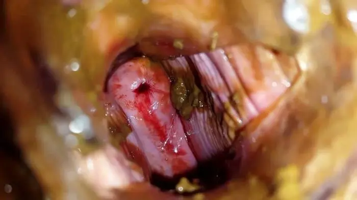 Shit and Blood Vol.5 Speculum Full version FullHD 1080p (Anna Coprofield /  2018) 1.97 GB ScatVip.com