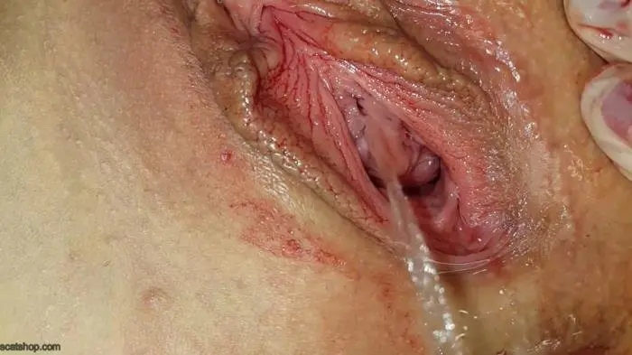 Shit and Blood Vol.8 Speculum FullHD 1080p (Anna Coprofield /  2019) 3.88 GB ScatVip.com