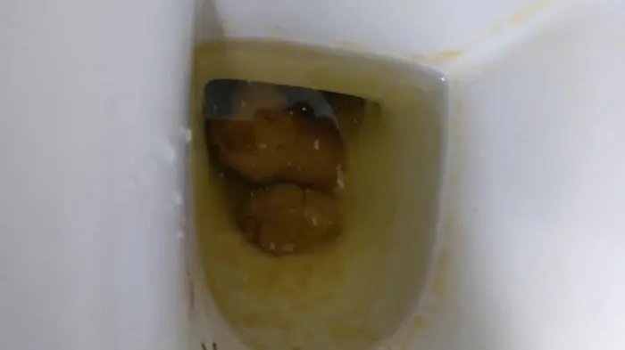 Talking on the toilet whilst shitting FullHD 1080p (PooGirlSofia /  2022) 735 MB ScatVip.com
