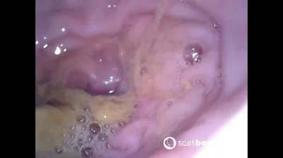Show Inside Of My Ass With Endoscope FullHD 1080p (Sweet Tinqerbell /  2025) 378 MB