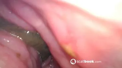 Endoscope In My Ass FullHD 1080p (Sweet Tinqerbell /  2025) 647 MB ScatVip.com