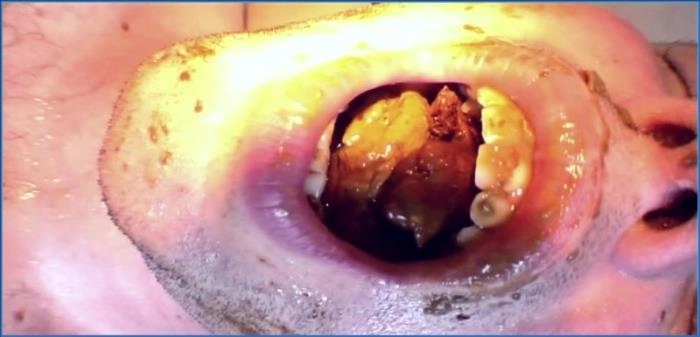 Lady Amy und Lady Atropa: Unvergessliche Scat-Sitzung mit Piss und Verbaler Erniedrigung in Latex - HD 720p