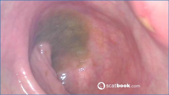 Endoskop in meinem Hintern FullHD 1080p - Heiße Action mit Tinker Star aus Russland! – ScatVip poster